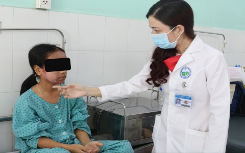 Khuôn mặt thiếu nữ lở loét vì kem lột trắng da